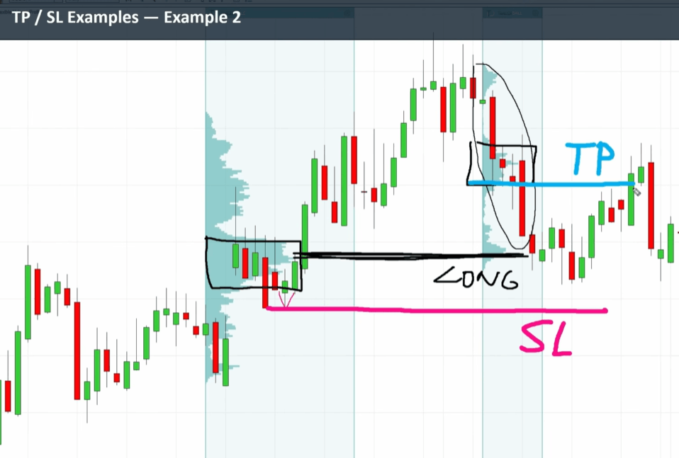 Chart showing a long trade from a Fair Value Gap with stop loss and take profit using Volume Profile